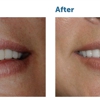 DuPage Dental Smiles gallery