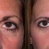 Hove Center for Facial Plastic Surgery gallery