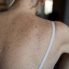Advanced Dermatology & Skin Cancer Specialists Victorville gallery