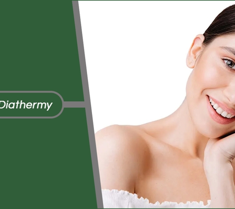 Sensational Beauty Therapy - Thornbury, VIC. Red Vein Diathermy