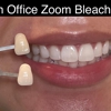 Precision Dental Care gallery
