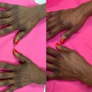 Tulua Medical - Med Spa Services Gilbert Arizona - Medical Spas