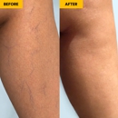 Metro Vein Centers | Westchester