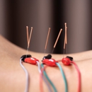 Angela Laurino L.Ac LMT. - Acupuncture