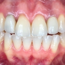 Nicole E. Kuske, DDS - Teeth Whitening Products & Services