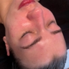 The Skin Angel Aesthetics gallery