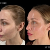 CosMedics Medical Aesthetic Clinic - Fenton gallery