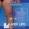 Laser Lipo and Vein Center gallery