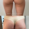 Naked MD gallery