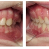 MI Smile Journey by Thomas Orthodontics - Saginaw gallery