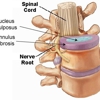 Bowden Chiropractic Physician - Advanced Spinal Rehabilitation gallery