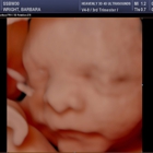 Heavenly 3D 4D Ultrasounds-Upland