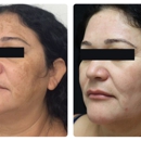 Glösense Dermatology & Aesthetic - Skin Care