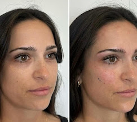 BeautyFULL Cosmetic Medical Clinic Kingscliff - Kingscliff, NSW