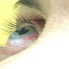Eye Care of Delaware