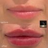 NU Med Spa Westlake Village gallery