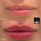 NU Med Spa Westlake Village