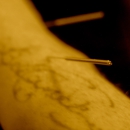 Infinite Wellness Acupuncture - Health Maintenance Organizations