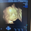 Baby Bee 3D Ultrasound + Photography Studio (Arlington) - Medical Imaging Services