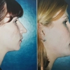 Royce Plastic Surgery gallery