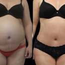 New York Group for Plastic Surgery - Day Spas