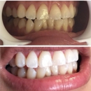 Diamond Smiles Teeth Whitening - Health & Wellness Products