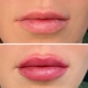 LivingYoung Center for Health & Anti-Aging - Odessa