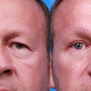 Plastic Surgery Center of Hampton Roads