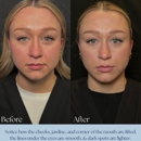 Hollywood Body & Face Denver/Metro - Day Spas