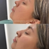NakedMD Med Spa Poway gallery