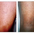 The Vein Center - Surgery Centers