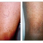 The Vein Center