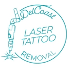 DelCoast Laser Tattoo Removal