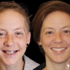 Birmingham Dental Implant Studio gallery