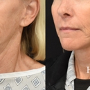 Harmon Facial Plastic Surgery - Physicians & Surgeons