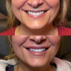 Nu Image Aesthetics & Wellness Institute Crystal Lake