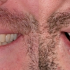 Hoopes Dental gallery