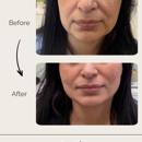 Permaskin Med Spa & Laser - Medical Spas