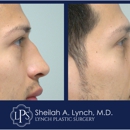 Sheilah A. Lynch, MD - Lynch Plastic Surgery - Physicians & Surgeons, Cosmetic Surgery