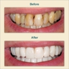 Palos Hills Dental, Anthony J. Tisoncik, DDS gallery