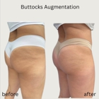 DermaSpalogy | Best Facials Miami | Botox Medspa Miami