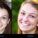 Smiles for Life Dental Care - Bridgewater - Prosthodontists & Denture Centers