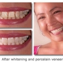 Radiant Smiles Dental: Wu Grace E DDS - Atlanta, GA