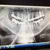 Blacks Fork Dental gallery
