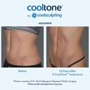 New Radiance Cosmetic Centers - Port St. Lucie - Hair Removal