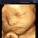 Heavenly 3d 4d Ultrasounds - Pregnancy Information & Services