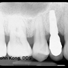 Better Living Through Dentistry™ : John Kong, DDS gallery