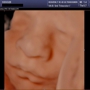 Heavenly 3D 4D Ultrasounds-Apple Valley