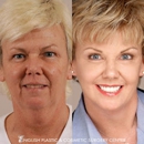 English Plastic and Cosmetic Surgery Center - Day Spas