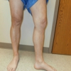 Vein and Laser Center gallery